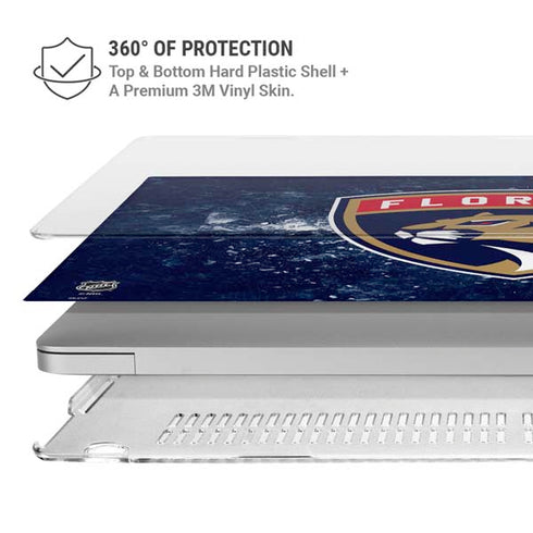 NHL Florida Panthers Frozen MacBook Air 15in (2023-2025) Case plus Skin
