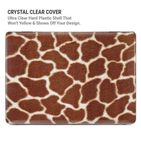 Giraffe MacBook Air 13in M1 (2021) Case plus Skin