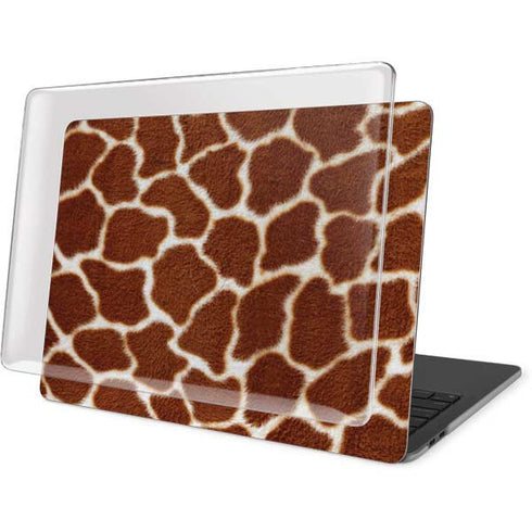 Giraffe Animal Print MacBook Pro 15in (2016-19) Case plus Skin