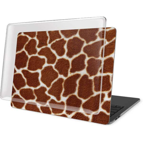 Giraffe Animal Print MacBook Pro 16in (2019-20) Case plus Skin