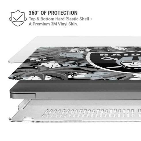NFL Las Vegas Raiders Tropical Print MacBook Pro 16in (2021-25) Case plus Skin