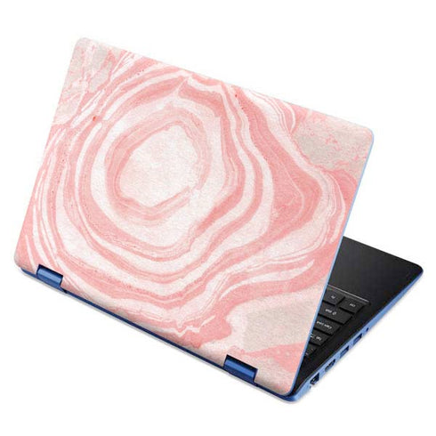 Marbleized Pink Aspire R11 11.6in Skin