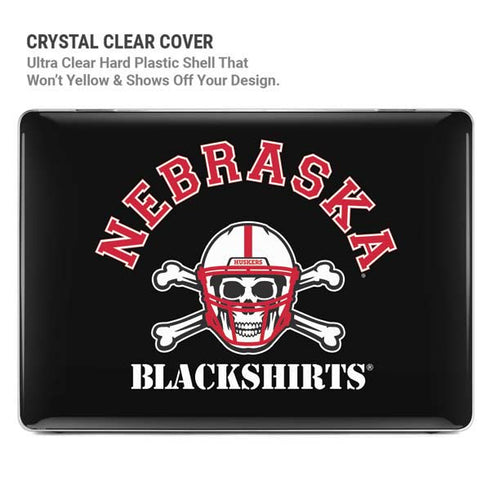 University of Nebraska Blackshirts MacBook Pro 16in (2021-25) Case plus Skin