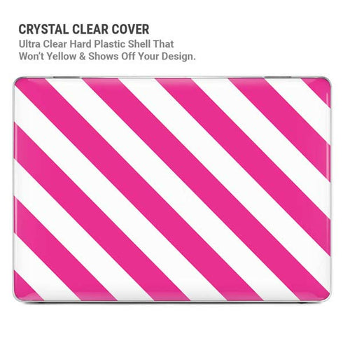 Pink and White Geometric Stripes MacBook Pro 13in (2020) Case plus Skin