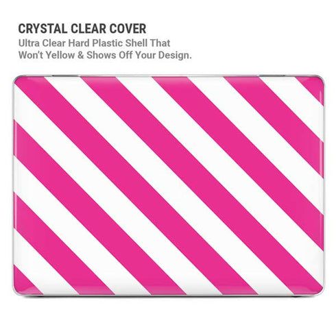 Pink and White Geometric Stripes MacBook Pro 16in (2021-25) Case plus Skin