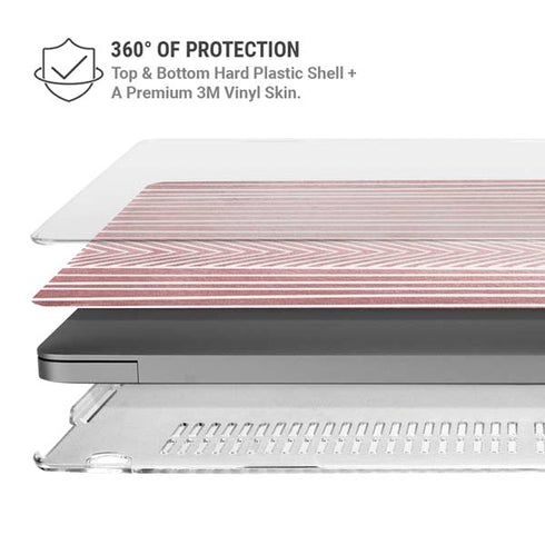 Pink and White Stripes MacBook Pro 16in (2021-25) Case plus Skin