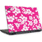 Pink and White Lenovo ThinkPad Skin