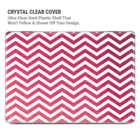Pink Chevron MacBook Pro 16in (2021-25) Case plus Skin