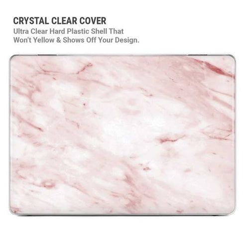 Pink Marble MacBook Air 15in (2023-2025) Case plus Skin