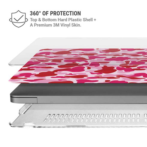 Pink Street Camo MacBook Pro 16in (2021-25) Case plus Skin