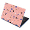 Pink Terrazzo Aspire R11 11.6in Skin