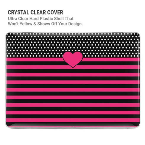 Polka Dots and Stripes Heart in Pink MacBook Pro 13in (2020) Case plus Skin