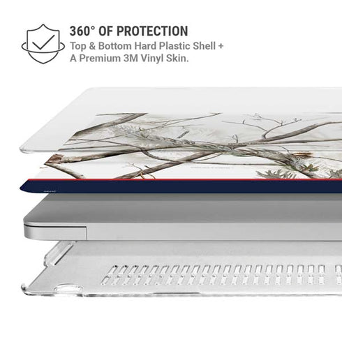 NFL Realtree Camo New England Patriots MacBook Pro 13in (2020) Case plus Skin