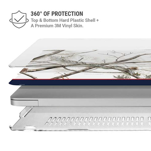 NFL Realtree Camo New England Patriots MacBook Pro 15in (2016-19) Case plus Skin