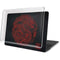 Red Dragon MacBook Pro 15in (2016-19) Case plus Skin