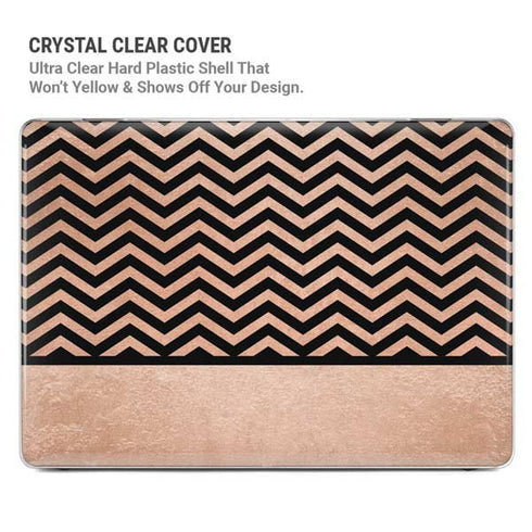 Rose Gold Chevron Split MacBook Pro 16in (2019-20) Case plus Skin