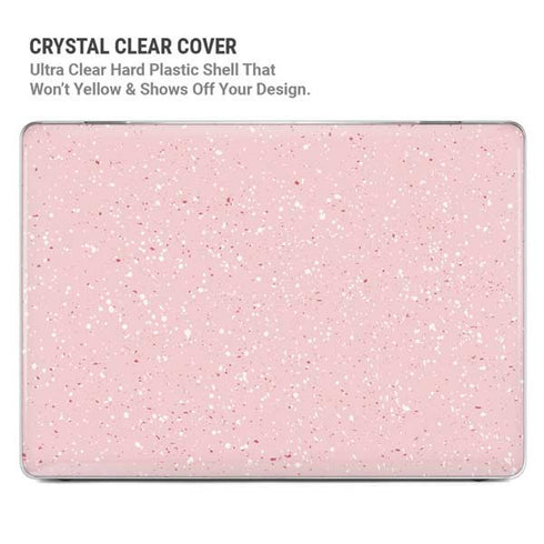 Rose Speckle MacBook Pro 16in (2021-25) Case plus Skin