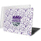 NBA Sacramento Kings History Logo Blast MacBook Pro 16in (2019-20) Case plus Skin