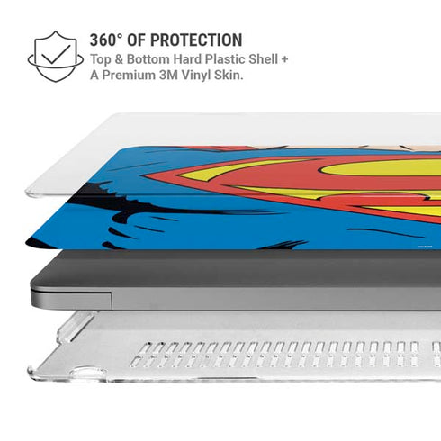 DC Comics Superman Vintage Chest MacBook Pro 16in (2021-25) Case plus Skin