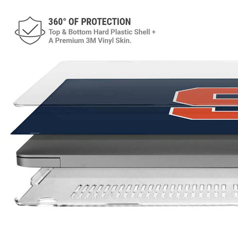 Syracuse University S Logo MacBook Pro 16in (2021-25) Case plus Skin