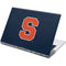Syracuse S Yoga 910 2-in-1 14in Touch-Screen Skin
