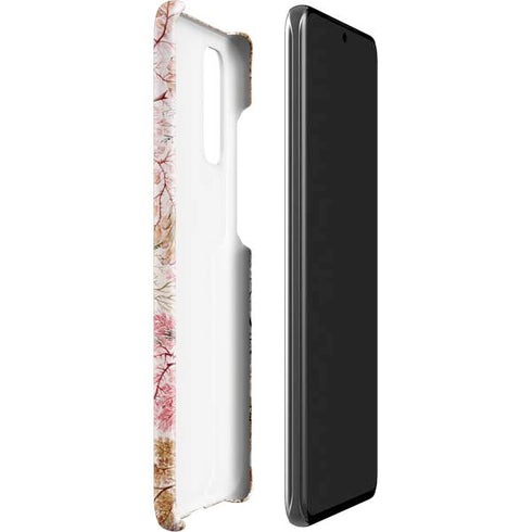 William Kilburn Textile Design Galaxy S20 Lite Case