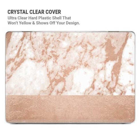 White Rose Gold Marble MacBook Air 15in (2023-2025) Case plus Skin
