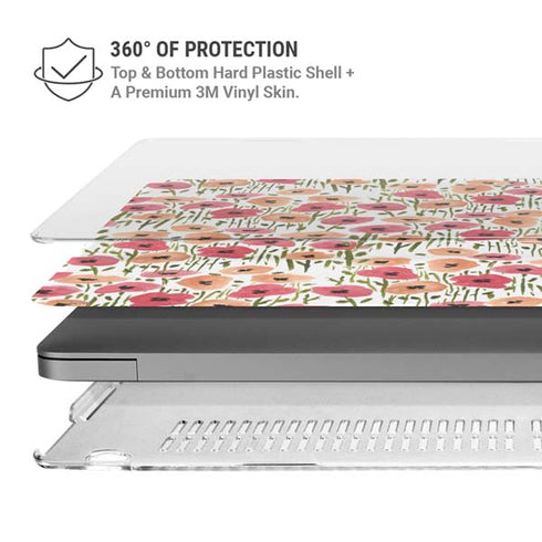 Bouffants and Broken Hearts Wild Garden MacBook Pro 16in (2021-25) Case plus Skin