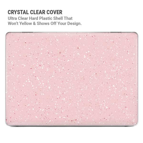 Rose Speckle MacBook Pro 14in (2021-24) Case plus Skin